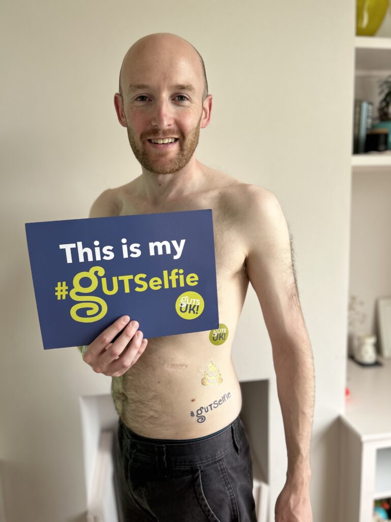 Ross' 2024 #GUTSelfie. He is standing smiling, holding his #GUTSelfie board to the camera, and he has temporary #GUTSelfie tattoos on his stomach.
