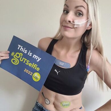 Leanne is smiling at the camera. She is wearing a black sports bra with a pair of jeans and holding a #GUTSelfie banner. She has a feeding tube passing into her nose which is taped on her cheek.