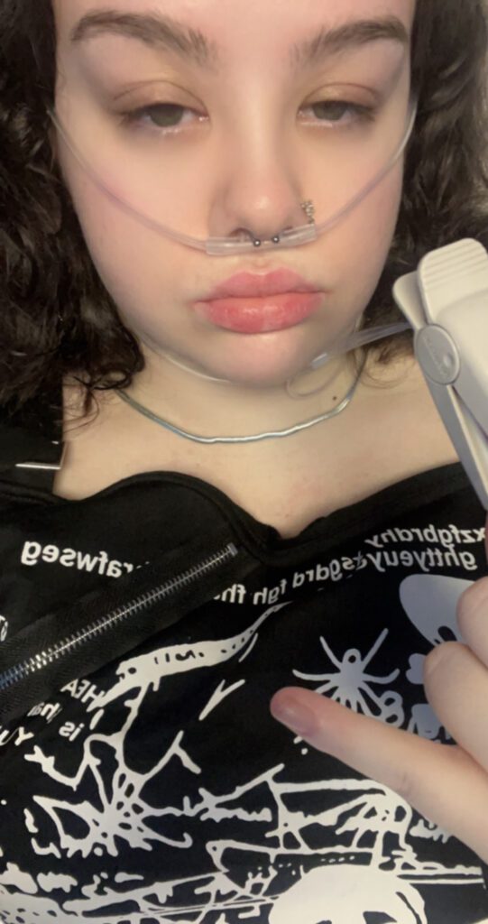 Rachel is in hospital and has an oxygen tube resting in her nostrils. She is looking at the camera and wears a black top with white detailing.