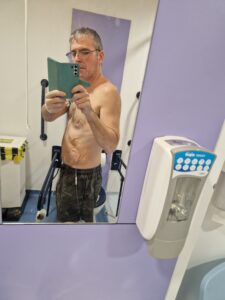 Cornelius is taking a mirror selfie in a toilet at a medical facility. He is topless with a pair of grey sweat bottoms. He has a tube attached to the side of his belly.