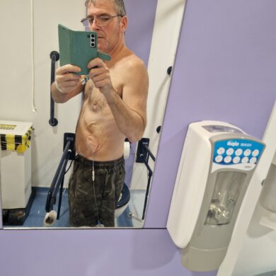 Cornelius is taking a mirror selfie in a toilet at a medical facility. He is topless with a pair of gray sweat bottoms. He has some tubes attached to the side of his belly.