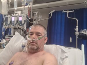 Cornelius is sat on a hospital bed attached to several tubes connecting to machines behind him. He is intubated with a breathing tube and is looking directly at the camera. 