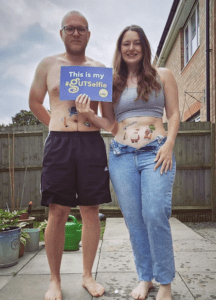 Sian and Matt are smiling at the camera with Guts UK's temporary #GUTSelfie tattoos on their bellies. Sian is holding a blue #GUTSelfie board in front of Matt's chest. They are stood in their garden.