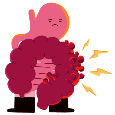An illustration of a gut with diverticula.
