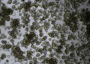 A microscopic image of miniguts organoids from the inflamed part of a patient's bowel.