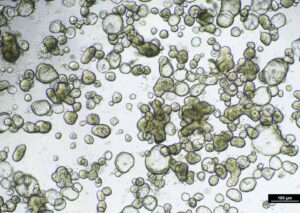 A microscopic image of miniguts organoids from the non-inflamed part of a patient's bowel.