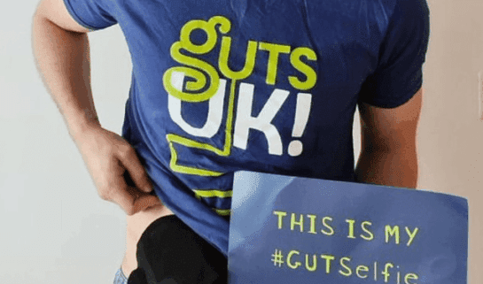 Ant is smiling at the camera, holding up the bottom of his blue Guts UK t-shirt to reveal a black ostomy bag. In the other hand, he holds a blue board which reads 