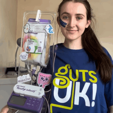 A #GUTSelfie of a girl wearing a navy Guts UK t-shirt. She is smiling, has long, dark brown hair and holds a purple and white feeding pump in her hand. She has a feeding tube going up her nose with navy feeding tube tape with white polka dots to hold it against her cheek.