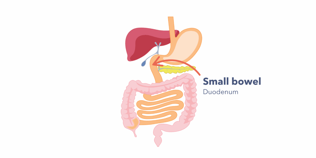 A diagram of the digestive system, with a label pointing to the start of the small bowel, the duodenum.