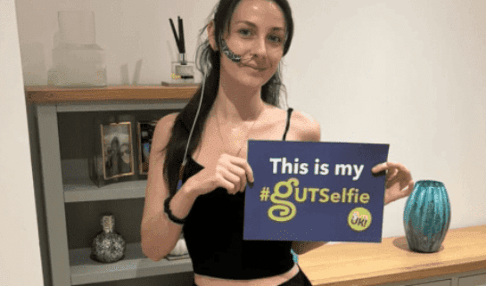 Jessie has long black hair, in a side ponytail over her shoulder. She is wearing a black vest top and leggings, and socks. She has a feeding tube going into her nose, with navy tape holding it to her left cheek. She is holding a #GUTSelfie board and smiles at the camera, in front of a grey bookcase and cabinet.