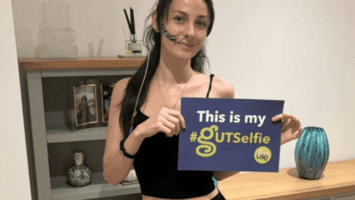 Jessie has long black hair, in a side ponytail over her shoulder. She is wearing a black vest top and leggings, and socks. She has a feeding tube going into her nose, with navy tape holding it to her left cheek. She is holding a #GUTSelfie board and smiles at the camera, in front of a grey bookcase and cabinet.
