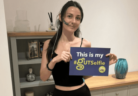 Jessie has long black hair, in a side ponytail over her shoulder. She is wearing a black vest top and leggings, and socks. She has a feeding tube going into her nose, with navy tape holding it to her left cheek. She is holding a #GUTSelfie board and smiles at the camera, in front of a grey bookcase and cabinet.