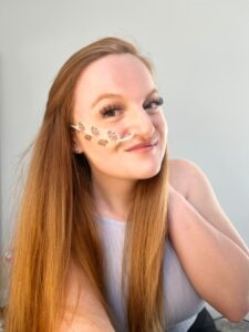 Rachel is smiling confidently with her long red hair. She has a nasal tube secured with decorative bee-patterned tape. The background is plain and light.
