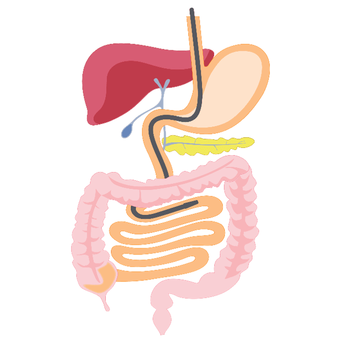 A diagram showing an endoscopy (tube down the throat) to look into the digestive tract.
