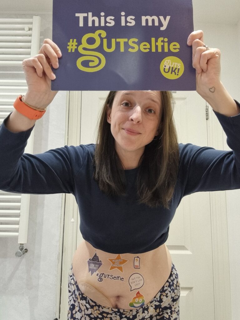 Lisa takes part in #GUTSelfie, holding up her #GUTSelfie board and showing her tummy, which is revealed by her rolled up, navy, long-sleeve top.