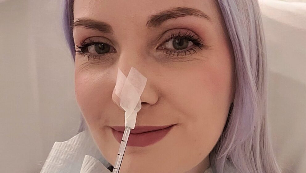 Leanne smiles at the camera in a selfie style photo. She has a feeding tube inserted into her nose and blue roll tucked into the collar of her t-shirt.