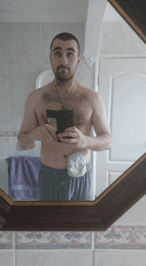 Sean takes a mirror selfie shortly after his surgery.