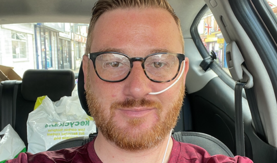 Toby, with short reddish-brown hair, glasses, and a beard, is sitting in the passenger seat of a car. He is wearing a maroon t-shirt and has a thin, white nasogastric (NG) tube inserted into his left nostril, secured to his cheek with clear adhesive. He is looking directly at the camera with a slight smile. In the background, there are white plastic shopping bags on the back seat and a street view through the car window.