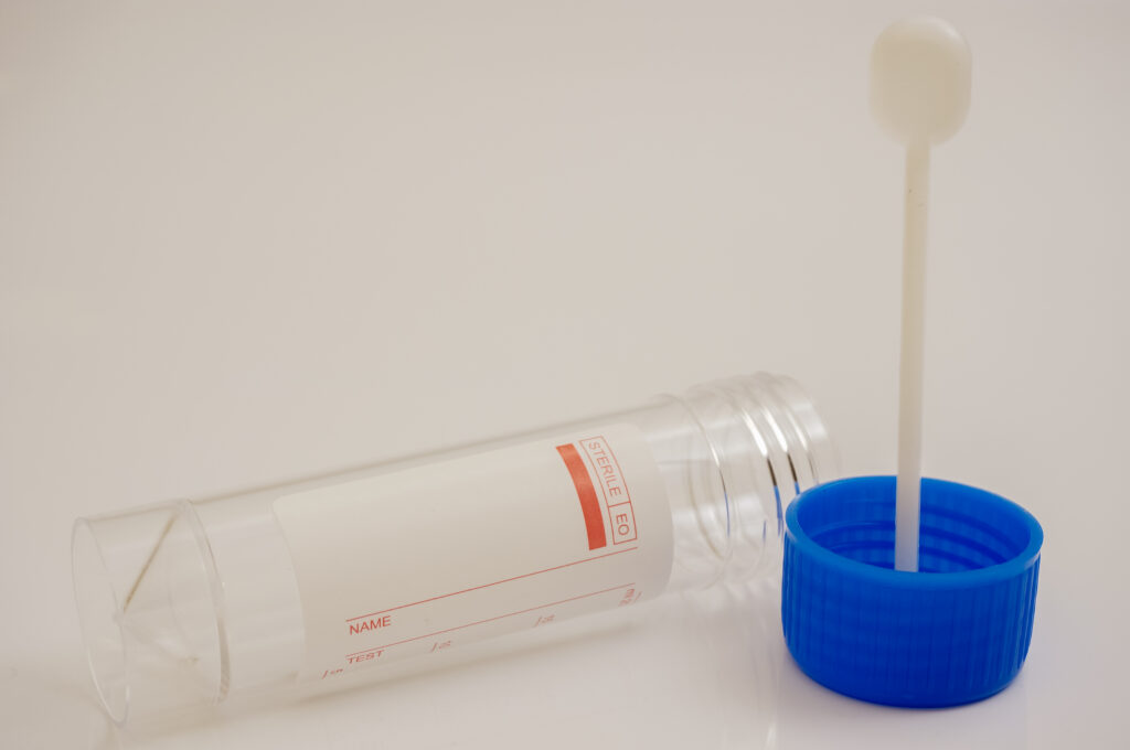 A medical collection kit is shown with an empty, labeled transport tube resting horizontally. Beside it stands the blue screw cap with a white plastic swab permanently attached to its inside. The red label has fields for "NAME" and "TEST." The kit is set against a plain white background.