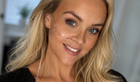 Close-up selfie of a blonde woman smiling with a NJ tube attached across her cheek.