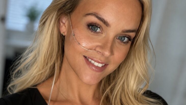 Close-up selfie of a blonde woman smiling with a NJ tube attached across her cheek.