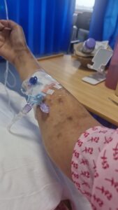 Pictured is Elizabeth's arm with drains to supply vitamins and nutrients to her body whilst she is in hospital